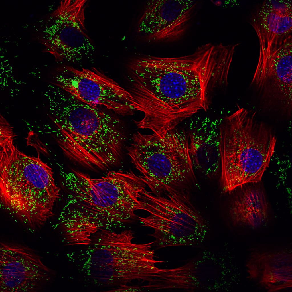 Image of confocal fluorescence imaging of a cell.
